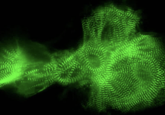 Sarcomeres glow in green stripes on a black background