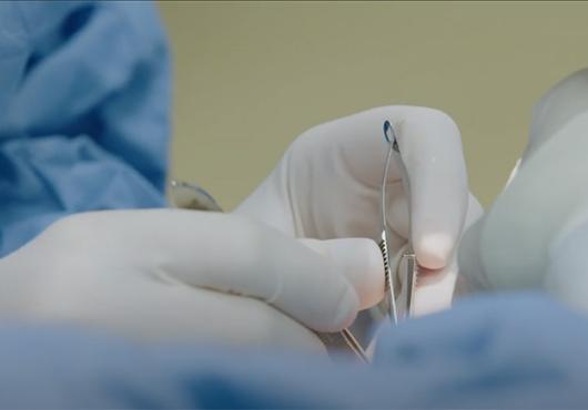 surgeon's hands holding implements