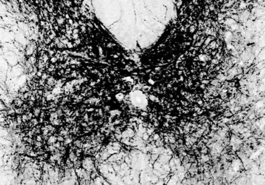 butterfly-shaped microscope image with green dots
