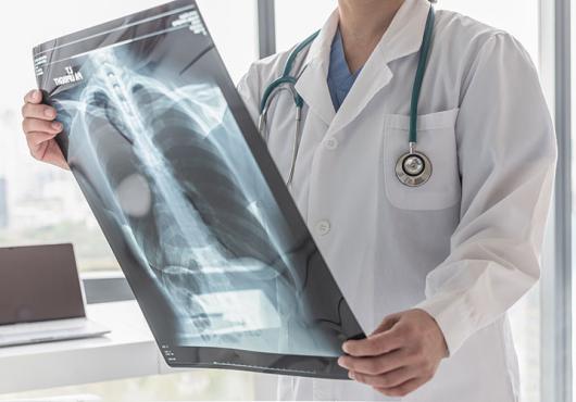 physician examines an X-ray of the lungs