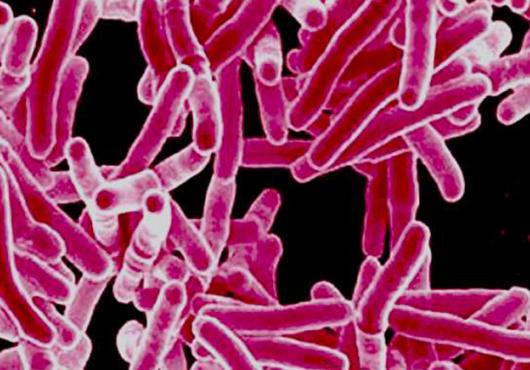 Rod-shaped tuberculosis bacteria