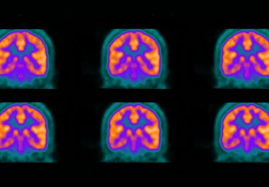 A colorful collage of purple, orange and turquoise images of a brain