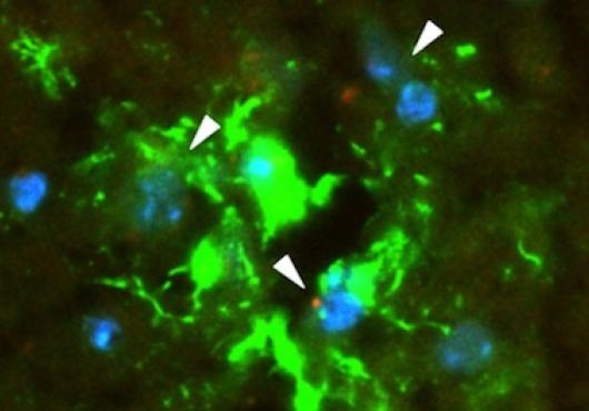 Cluster of bright green cells with a few red dots scattered throughout