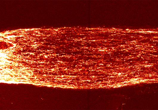 Fiery-looking bundle of nerves is white on the left side and orange-red on the right side against a black ground