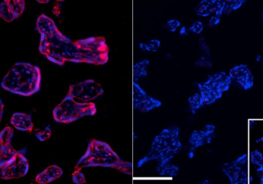 Side by side micrographs show cells lit in purple (left) and blue (right) against a black background