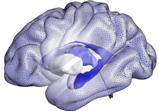 A computational model of brain structures that form the basis of BrainPrint, a system for representing the whole brain based on the shape, rather than the size, of structures. Image: Martin Reuter and Christian Wachinger/Martinos Center for Biomedical Imaging, Mass General