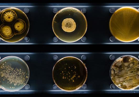 six Petri dishes containing different types of bacteria