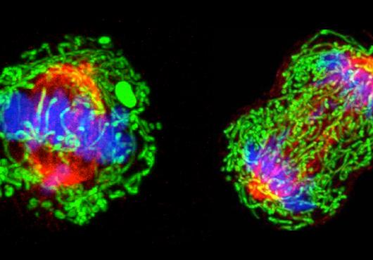 breast cancer cell dividing