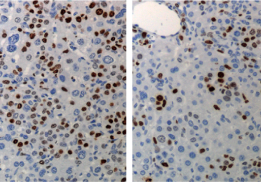Lung cancer cells are reduced in the treated mouse (right) compared to control mouse (left)