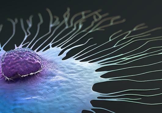 Digital illustration of a single breast cancer cell spreading