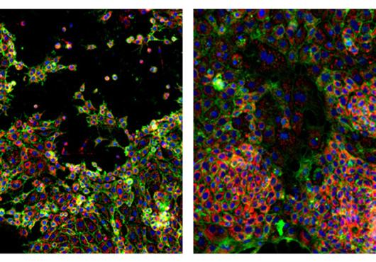 cancer cells