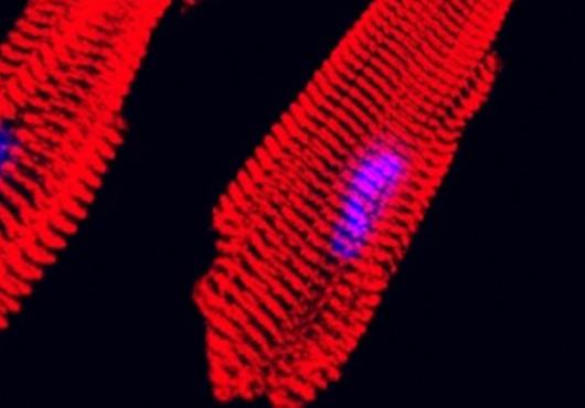 Microscopy image of red striated heart muscle fibers with blue nuclei