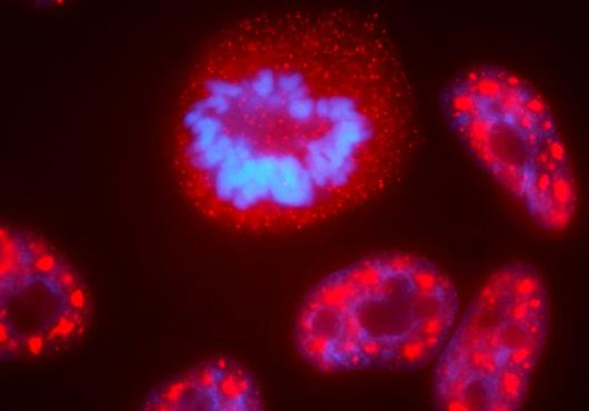 microscopy image of a cell nucleus showing distinct compartments