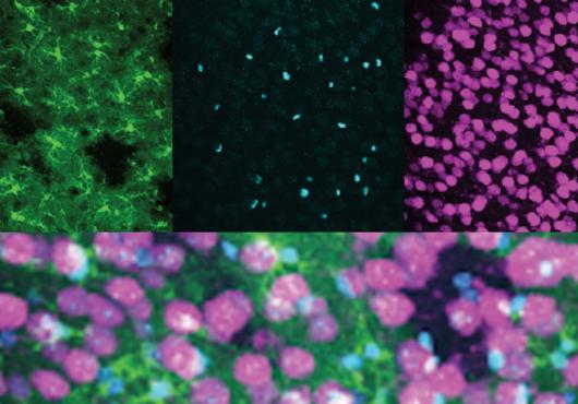 four microscopy images in green, purple and blue