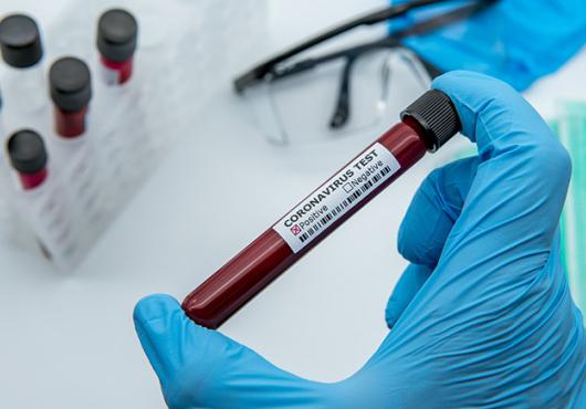 a gloved hand holds a test tube