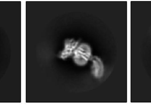 Three black-and-white microscope images of a protein with three segments, the third one curved like a tail