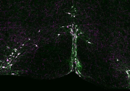 Arc of neurons in purple and green