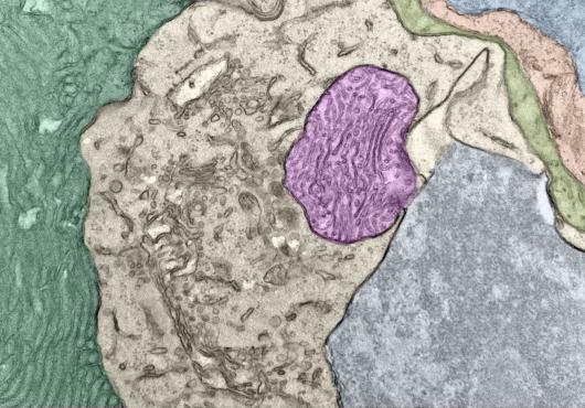 Colorized micrograph shows a magenta blob amid gray and beige blobs, with a green background