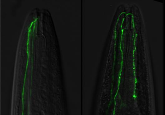 fluorescent neuron is longer than normal