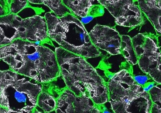 Microscopy shows cells in green and nuclei in blue