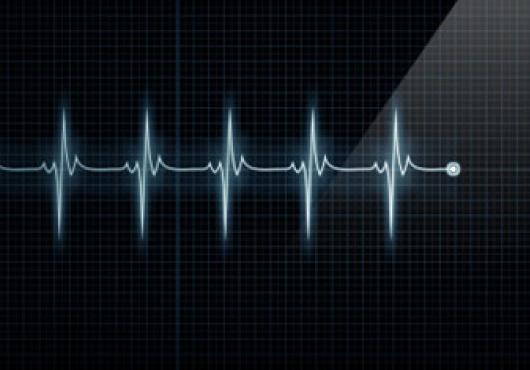 A heart monitor