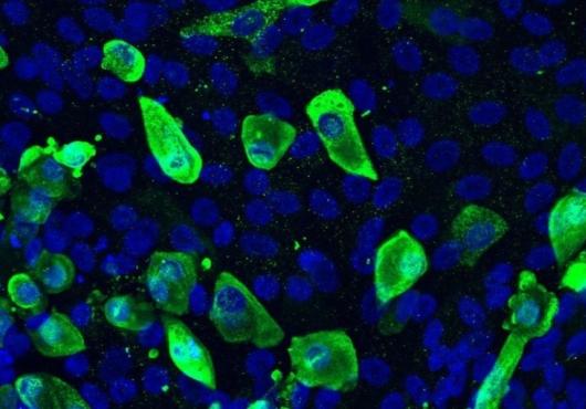 Magnified cells glow green and blue against a black background