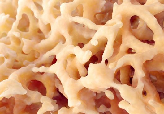 Bone structure