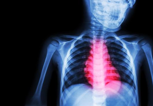 Illustration of reddened heart against blue skeleton X-ray
