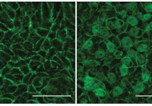 Two micrographs side by side wih green-stained cells arranged in different patterns
