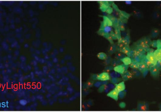On the right, increased LDL uptake (in red) and GFP in cells after Cas9 repair of a mutation in the LDLR gene found to cause abnormally high cholesterol. 