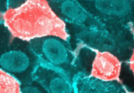 Microscope image of cells with SARS-CoV-2 penetration, indicated by pink stain on teal cells