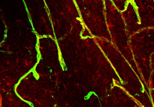 Image of blood brain barrier 