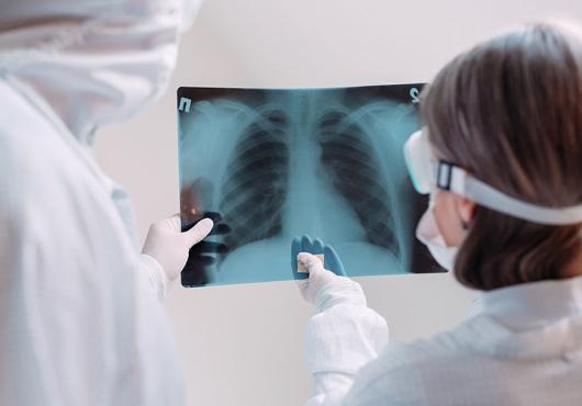 two clinicians in white coats and face masks examine an X-ray image