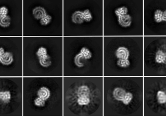 18 square microscopy images of curly protein in different orientations