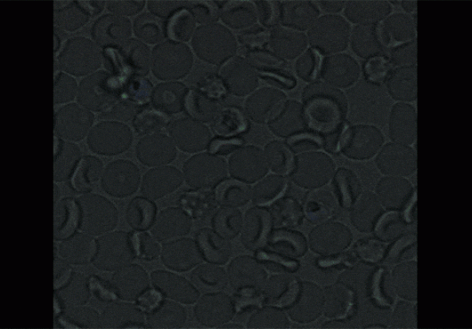 parasites suck it up