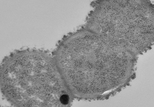 R. gnavus bacteria in three connected round segments, gray against a lighter gray background