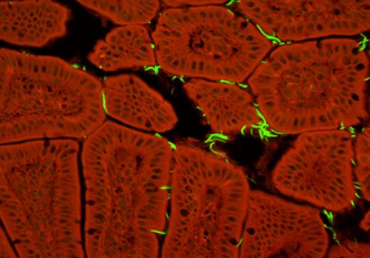 Our Microbes, Ourselves