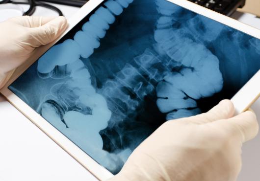Two hands wearing white latex gloves hold a tablet showing an X-ray image of intestines and spine