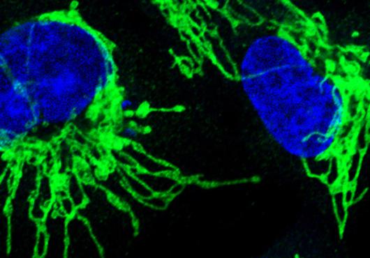 Microscopy image of two cell nuclei in blue and spindly misshapen mitochondria in green against a black background