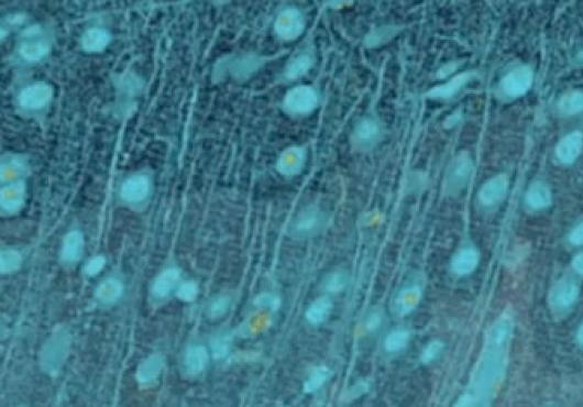 Web-Crawling the Brain