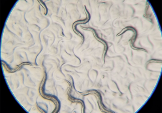 worms squiggle across a microscope slide