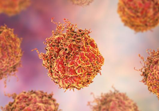 Prostate Cancer cells