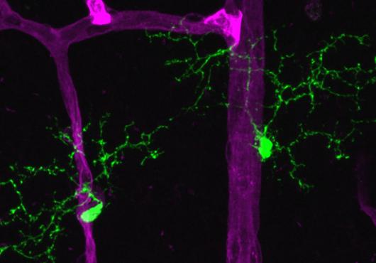 retinal microglia and retinal vasculature