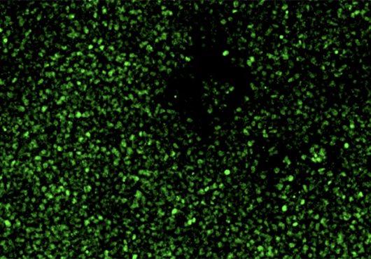 Field of hundreds or thousands of cells glow green against a black background 
