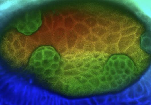 A time lapse microscope image of cells forming the semicircular canals