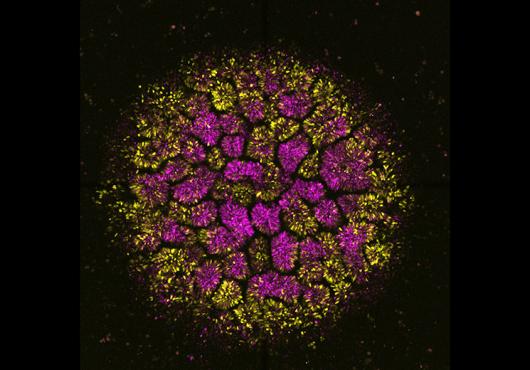 Microscope image shows a round conglomeration of cells dyed purple and yellow