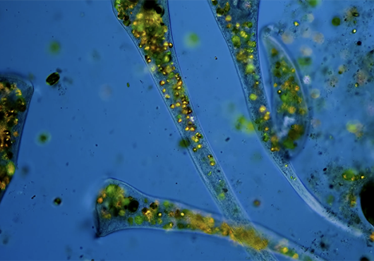 a micrograph of trumpet-shaped Stentor roeselii