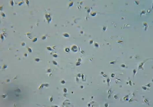 Grayscale image of sperm cells under a microscope