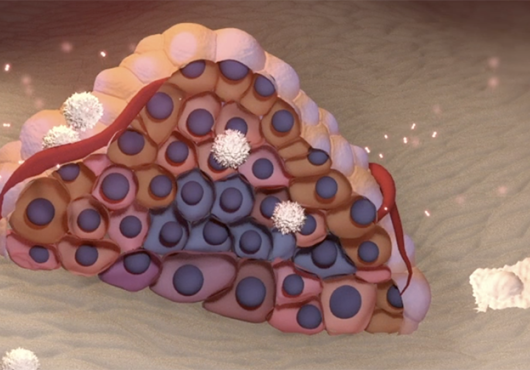 illustration of a small tumor