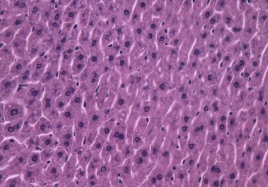 Histology slides show lipid molecules in mouse livers